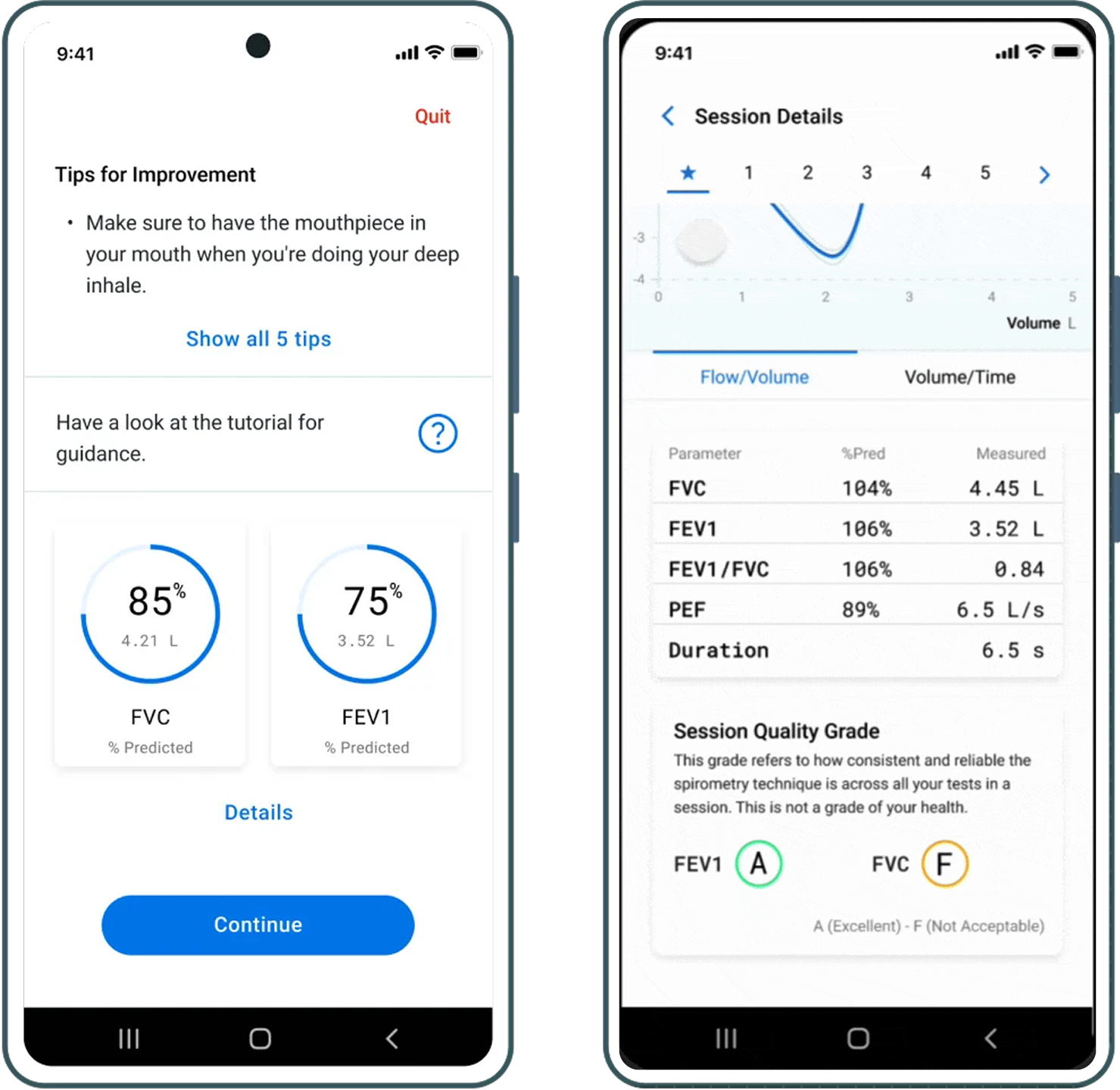 Updated results page provide a clearer look into a patients' lung function, with tips for improving technique if mistakes were made.